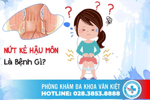 Nứt kẻ hậu môn là bệnh gì? Nguyên nhân và cách điều trị hiệu quả