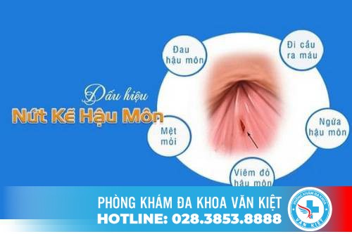 Dấu hiệu bệnh nứt kẽ hậu môn
