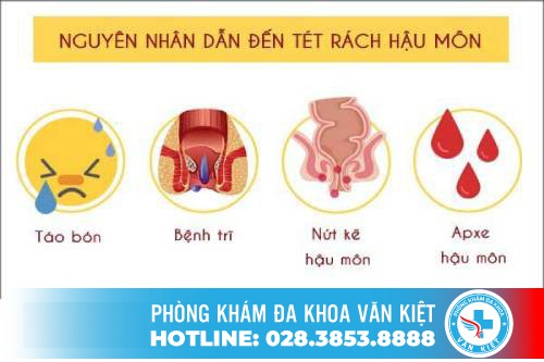 Rách hậu môn có nguy hiểm không? Nguyên nhân và cách điều trị