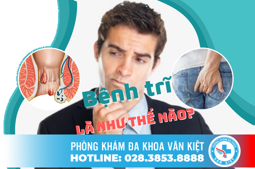 Bệnh trĩ là gì? Dấu hiệu và cách điều trị hiệu qủa