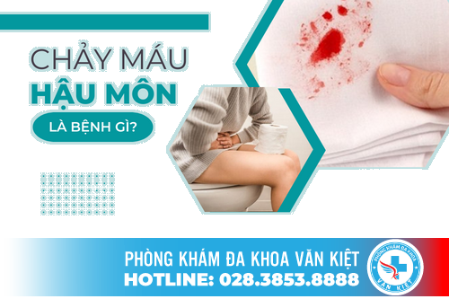 Chảy máu hậu môn là do bệnh gì gây ra? Phương pháp điều trị bệnh hiệu quả nhất hiện nay là gì?