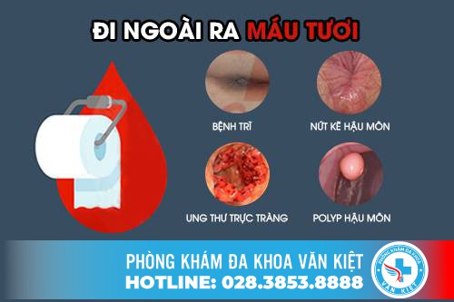 Đi Ỉa Ra Máu – Cảnh Báo Đã Mắc Phải Các Bệnh Hậu Môn Nguy Hiểm
