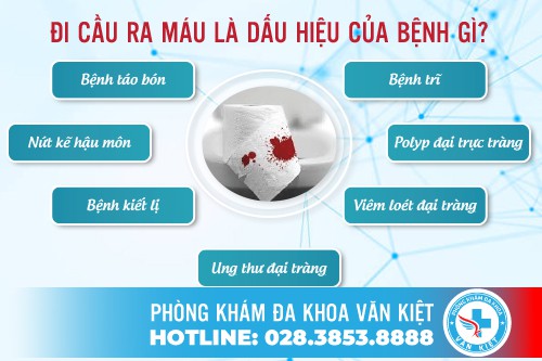 Đi cầu ra máu - dấu hiệu nhiều bệnh lý nguy hiểm
