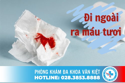 Đi ngoài ra máu tươi - nguyên nhân và cách chữa trị hiệu quả