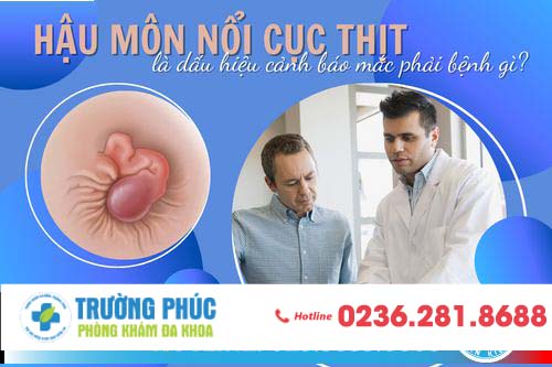 Hậu môn bị nổi cục thịt là dấu hiệu cảnh báo mắc phải bệnh gì? Phương pháp trị bệnh hiệu quả