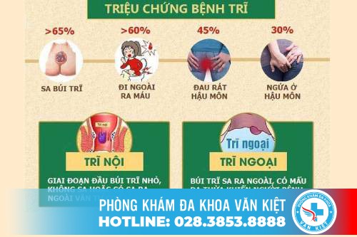 Cách nhận biết bệnh trĩ
